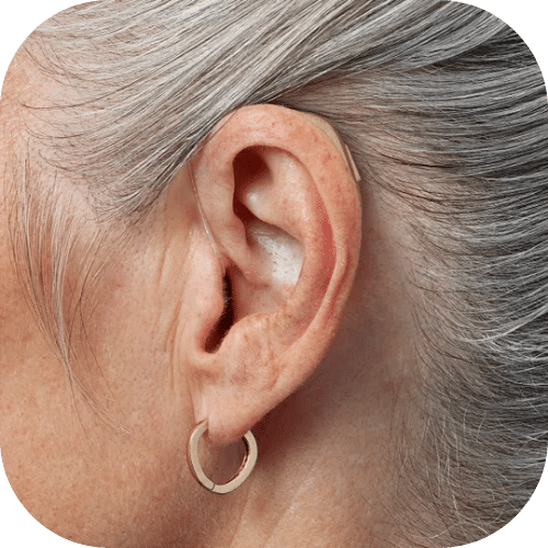 bernafon hearing aids
